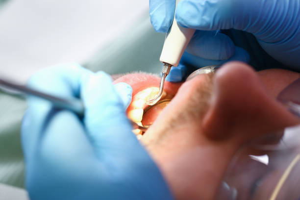 Best 24-Hour Emergency Dentist in Williamsburg, VA