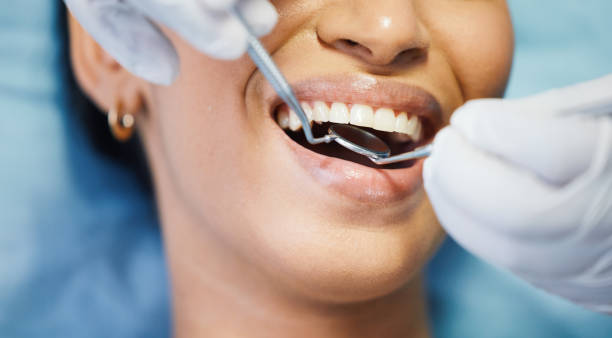 Best Emergency Treatment for Toothache in Williamsburg, VA