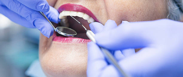 Best Emergency Treatment for Toothache in Williamsburg, VA